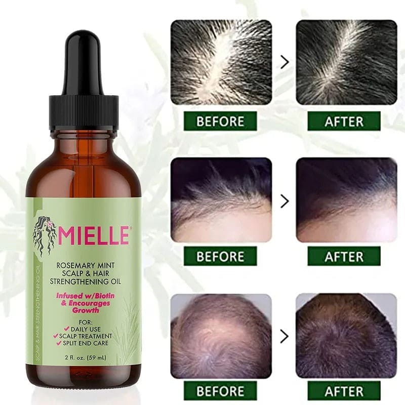 Premium Rosemary Hair Growth Oil